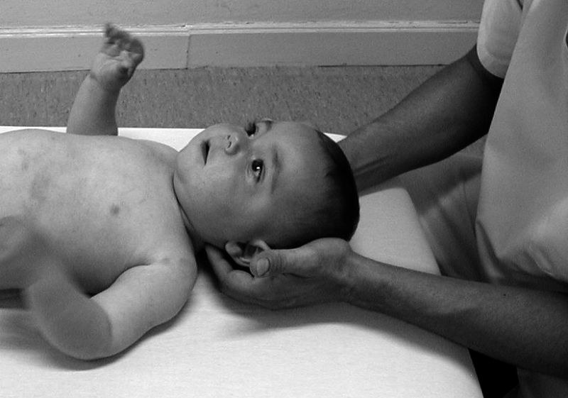 Osteopatia_pediatrica