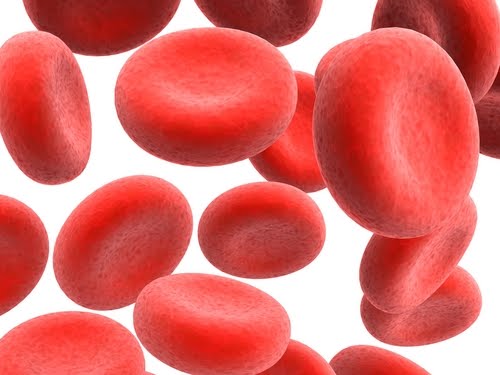 anemia