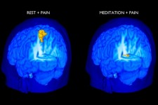 Meditar