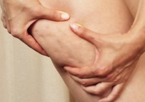 celulitis-en-piernas